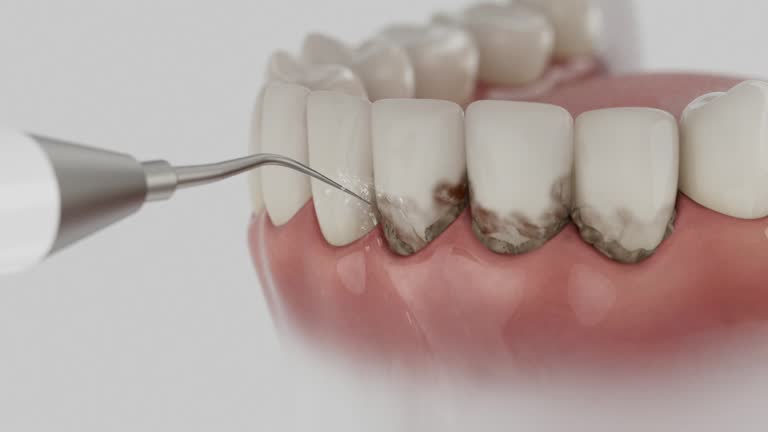 Reliable Dental Implants contractor in Fiskdale, MA by Smile Center Dentistry